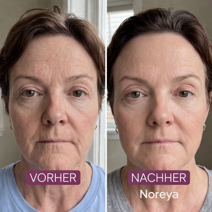 Kojic Acid Kurkuma Overnight Maske